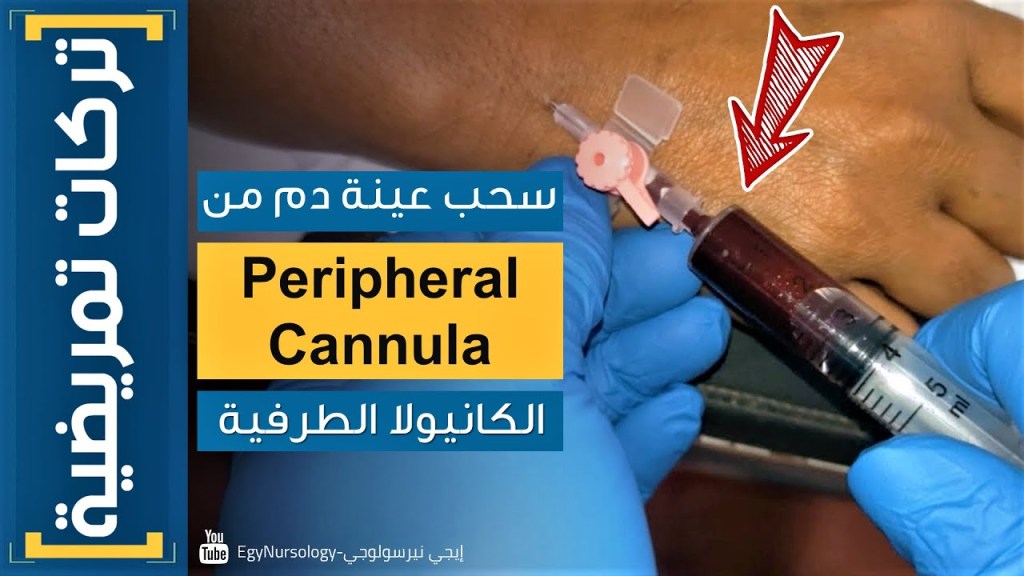 تركات تمريضية | (1) طريقة سحب عينة دم من الكانيولا&nbsp;الطرفية