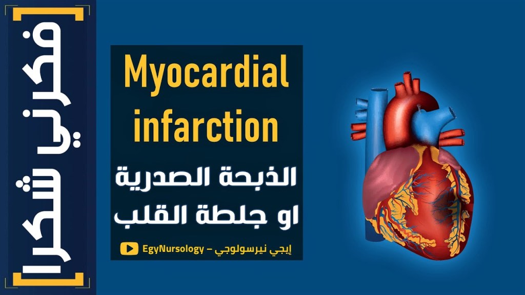 فكرني شكرا | (1) شرح علاج الـ (Myocardial infarction) الذبحة الصدرية او جلطة&nbsp;القلب